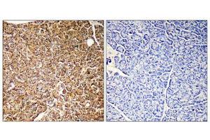 Immunohistochemistry (IHC) image for anti-Phosphoinositide-3-Kinase, Catalytic, gamma Polypeptide (PIK3CG) (Internal Region) antibody (ABIN1852676) (PIK3 gamma antibody  (Internal Region))