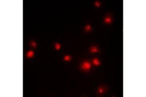 Immunofluorescence (IF) image for anti-Enhancer of Zeste Homolog 2 (EZH2) antibody (ABIN7307768)