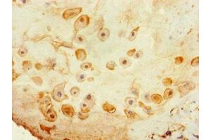 Immunohistochemistry of paraffin-embedded human placenta tissue using ABIN7171850 at dilution of 1:100 (Tetraspanin 14 antibody  (AA 114-215))