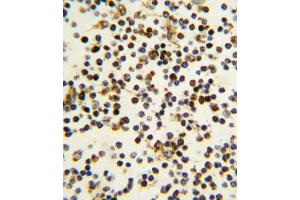 Immunohistochemistry (IHC) image for anti-Nucleophosmin (Nucleolar phosphoprotein B23, Numatrin) (NPM1) antibody (ABIN3001656)