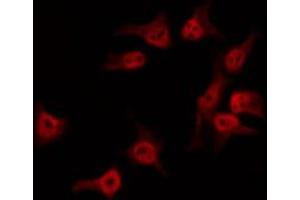 ABIN6274111 staining HuvEc by IF/ICC. (NEMF antibody  (C-Term))