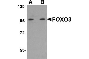 Western Blotting (WB) image for anti-Forkhead Box O3 (FOXO3) (N-Term) antibody (ABIN1031384) (FOXO3 antibody  (N-Term))