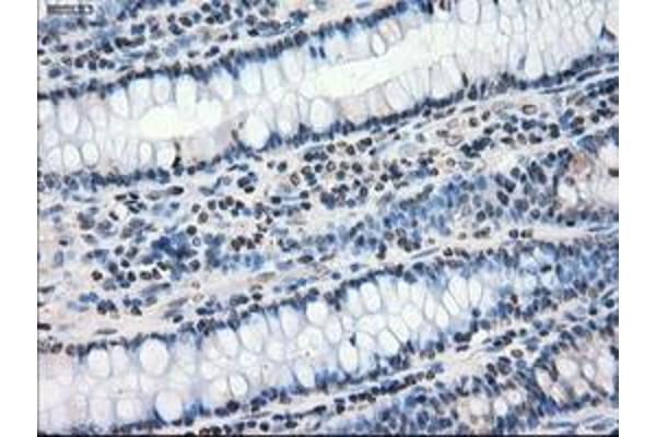 PP5 antibody