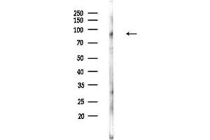 Western blot analysis of lysates from Mouse lung, using ADAM30 Antibody at 1/1000 dilution.