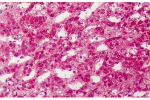 Human Adrenal: Formalin-Fixed, Paraffin-Embedded (FFPE) (PPARG antibody  (Internal Region))