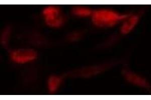 ABIN6278347 staining  MDA-MB-435 cells by IF/ICC. (SENP2 antibody)