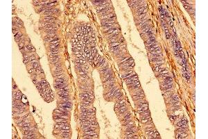 Immunohistochemistry (IHC) image for anti-Tumor Necrosis Factor Receptor Superfamily, Member 1A (TNFRSF1A) (AA 263-468) antibody (ABIN7173825)