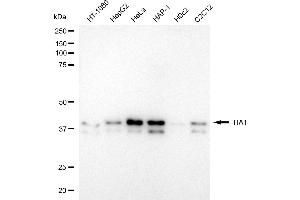 Western blotting analysis using TIA1 antibody (ABIN7800557). (Recombinant TIA1 antibody)