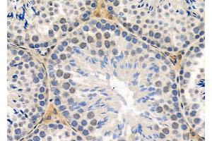 ABIN6260374 and ABIN6279100 at 1/100 staining Mouse testis tissue by IHC-P. (RPP25L antibody  (C-Term))