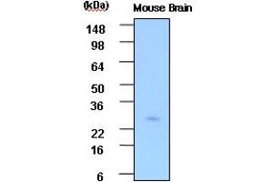 Western blot analysis: Cell lysates of Mouse brain(30ug) were resolved by SDS-PAGE, transferred to PVDF membrane and probed with anti-human PSP (1:1000). (STXBP3 antibody)