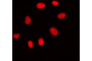 Immunofluorescent analysis of CDC25C staining in A431 cells. (CDC25C antibody  (Center))