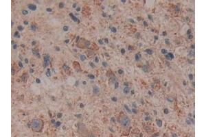 Immunohistochemistry (IHC) image for anti-Cytochrome C, Somatic (CYCS) (AA 5-100) antibody (ABIN7442270)