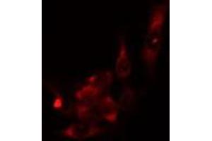 ABIN6276817 staining  HuvEc cells by IF/ICC. (AKR1B1 antibody  (C-Term))