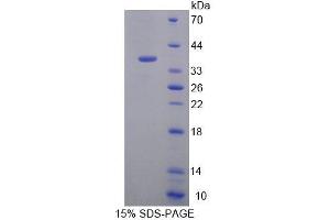 SDS-PAGE analysis of Human EEF1d Protein. (EEF1D Protein)