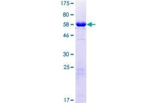 CHMP6 Protein (AA 1-201) (GST tag)