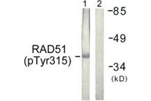 Western blot analysis of extracts from Jurkat cells, using RAD51 (Phospho-Tyr315) Antibody. (RAD51 antibody  (pSer315))