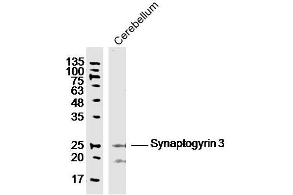 Synaptogyrin 3 antibody  (AA 101-200)