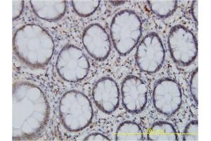 Immunoperoxidase of monoclonal antibody to SPAST on formalin-fixed paraffin-embedded human colon. (Spastin antibody  (AA 200-304))