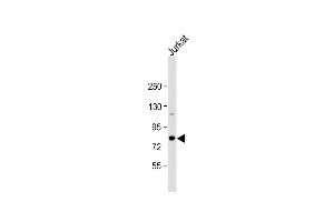 Anti-ALKBH8 Antibody (C-term) at 1:1000 dilution + Jurkat whole cell lysate Lysates/proteins at 20 μg per lane. (ALKBH8 antibody  (C-Term))