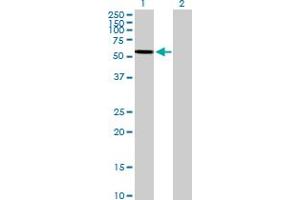 Western Blot analysis of ARSA expression in transfected 293T cell line by ARSA MaxPab polyclonal antibody. (Arylsulfatase A antibody  (AA 1-507))