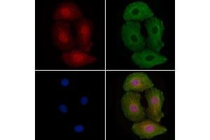 ABIN6255774 and ABIN6267285 staining Hela cells(4h of LPS treatment) by IF/ICC.