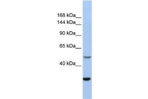 Human Jurkat; WB Suggested Anti-ZZZ3 Antibody Titration: 0. (ZZZ3 antibody  (Isoform 3, Middle Region))