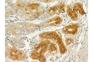 ABIN6257483 and ABIN6274777 at 1/100 staining human normal gastric tissue by IHC-P.