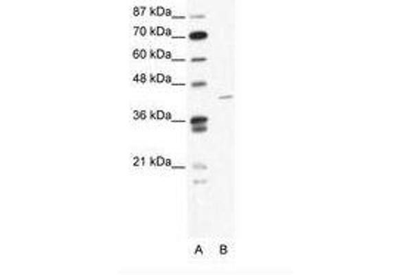 ZNF568 Antikörper  (AA 121-170)