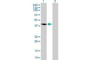 Western Blot analysis of FCER2 expression in transfected 293T cell line by FCER2 MaxPab polyclonal antibody. (FCER2 antibody  (AA 1-321))