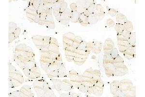 ABIN7093264 and ABIN7097283 at 1/100 staining Mouse muscle tissue by IHC-P.