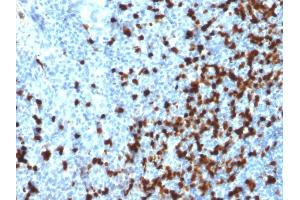 Immunohistochemistry (IHC) image for anti-T-Cell Leukemia/lymphoma 1A (TCL1A) (AA 2-109) antibody (ABIN6940949)