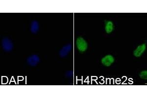 Immunofluorescence analysis of 293T cell using H4R3me2s antibody. (Histone 3 antibody  (2meArg3))