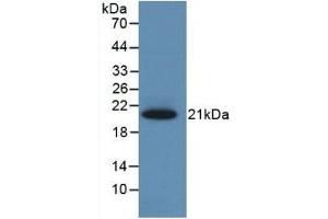 Detection of Recombinant CBG, Rat using Monoclonal Antibody to Corticosteroid Binding Globulin (CBG) (SERPINA6 antibody  (AA 173-344))