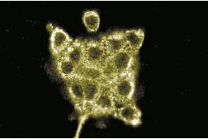 Immunofluorescence staining of A431 cells (human epithelial carcinoma, ATCC CRL-1555). (AKAP9 antibody  (AA 17-130))