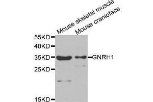 Western Blotting (WB) image for anti-Gonadotropin-Releasing Hormone 1 (Luteinizing-Releasing Hormone) (GNRH1) antibody (ABIN1876826) (GNRH1 antibody)