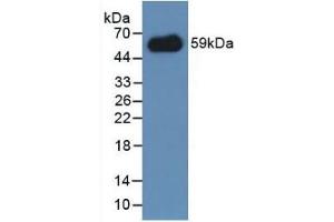 Detection of Recombinant IREM1, Mouse using Polyclonal Antibody to Immune Receptor Expressed On Myeloid Cells 1 (IREM1) (IREM1 antibody  (AA 45-310))