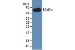 Detection of Recombinant IREM1, Mouse using Polyclonal Antibody to Immune Receptor Expressed On Myeloid Cells 1 (IREM1) (IREM1 antibody  (AA 45-310))