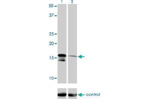 Western blot analysis of AGTRAP over-expressed 293 cell line, cotransfected with AGTRAP Validated Chimera RNAi (Lane 2) or non-transfected control (Lane 1). (AGTRAP antibody  (AA 108-159))