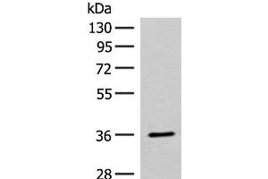 Western blot analysis of Mouse small intestines tissue lysate using FAM84A Polyclonal Antibody at dilution of 1:300 (FAM84A antibody)