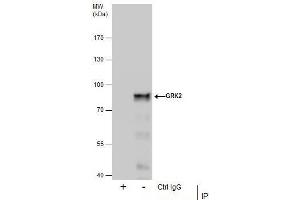 Immunoprecipitation (IP) image for anti-Adrenergic, Beta, Receptor Kinase 1 (ADRBK1) (C-Term) antibody (ABIN2855125)