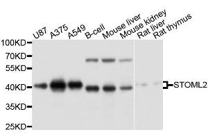 Western blot analysis of extracts of various cell lines, using STOML2 antibody. (STOML2 antibody  (AA 29-356))