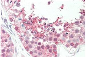 Human Testis: Formalin-Fixed, Paraffin-Embedded (FFPE) (BAT3 antibody  (C-Term))