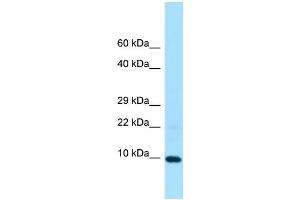 WB Suggested Anti-LSM5 Antibody Titration: 1. (LSM5 antibody  (Middle Region))
