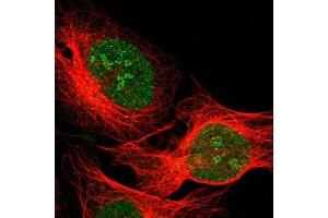 Immunofluorescent staining of human cell line U-2 OS with DLG3 polyclonal antibody  at 1-4 ug/ml shows positivity in nucleus & nucleoli. (DLG3 antibody)