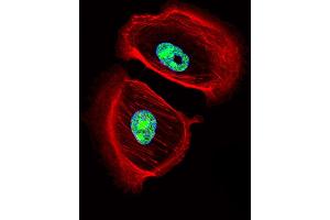 Fluorescent confocal image of SK-BR-3 cell stained with ARNT2 Antibody . (ARNT2 antibody  (AA 249-278))
