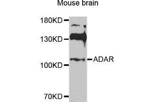 Western blot analysis of extracts of various cell lines, using ADAR antibody. (ADAR antibody  (AA 150-250))