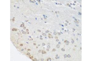Immunohistochemistry of paraffin-embedded Mouse brain using PUM1 Polyclonal Antibody at dilution of 1:100 (40x lens). (PUM1 antibody)