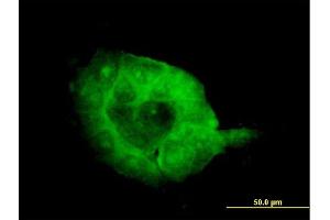 Immunofluorescence of monoclonal antibody to SH3BP2 on A-431 cell. (SH3BP2 antibody  (AA 452-561))