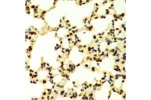 Immunohistochemistry of paraffin-embedded Mouse lung using TriMethyl-Histone H3-K9 antibody. (Histone 3 antibody  (H3K9me3))