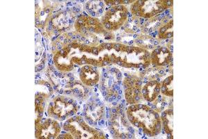Immunohistochemistry of paraffin-embedded mouse kidney using AMPKβ1 antibody (ABIN6134216, ABIN6146175, ABIN6146177 and ABIN6223916) at dilution of 1:100 (40x lens). (PRKAB1 antibody)